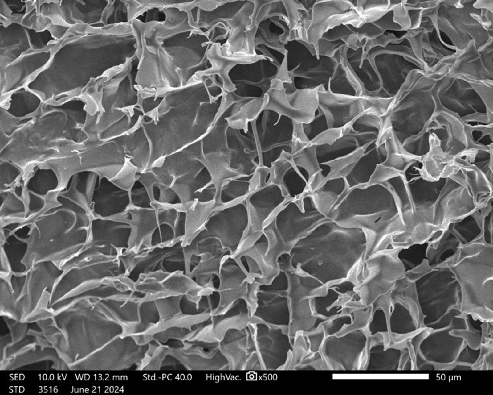 Scanning electron micrograph of the porous architecture of a chitosan hydrogel