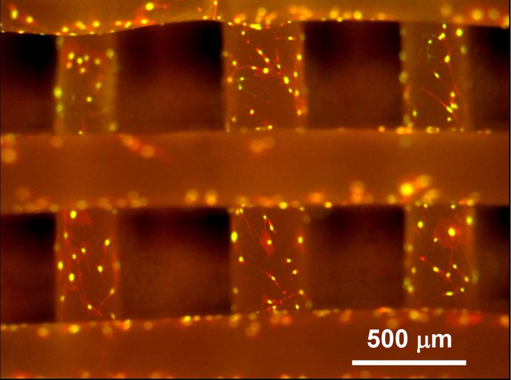 Fluorescence micrograph of bone cells proliferating across a tissue-engineering scaffold