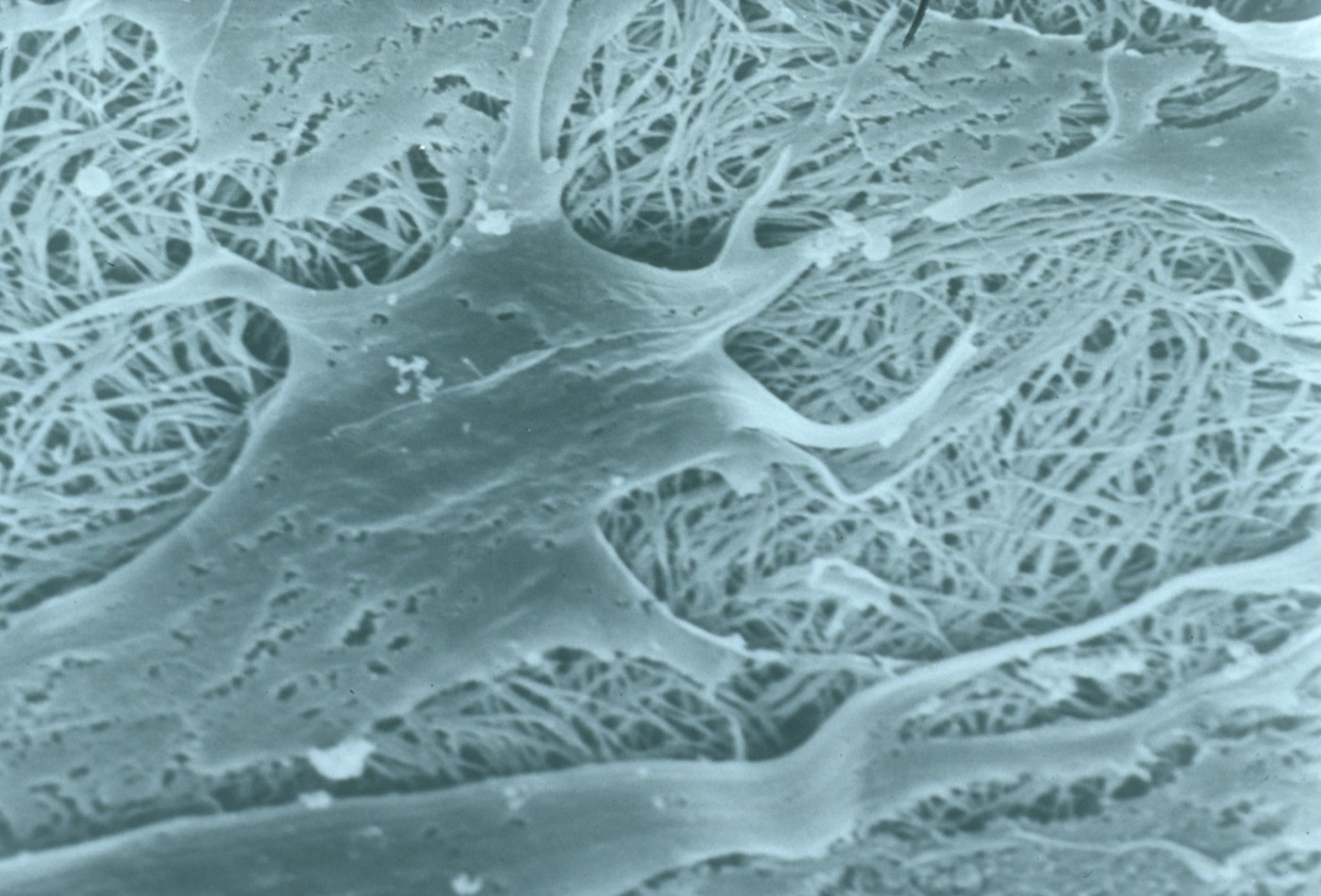 Cells interacting with a collagen scaffold in a scanning electron micrograph