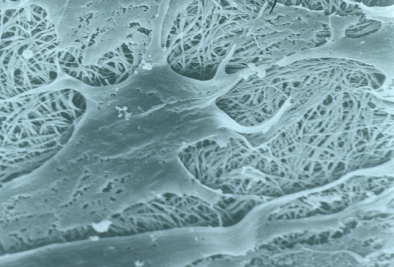 Cells interacting with a collagen scaffold in a scanning electron micrograph