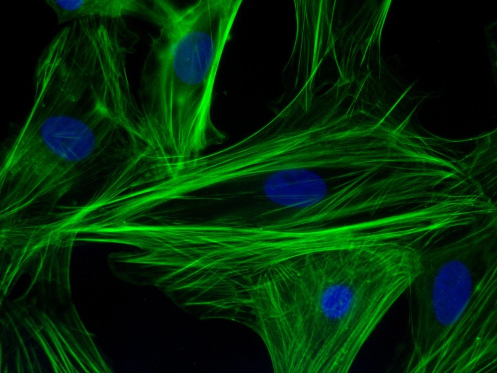 Immunofluorescence of F-actin and nuclei in neonatal cardiomyocytes