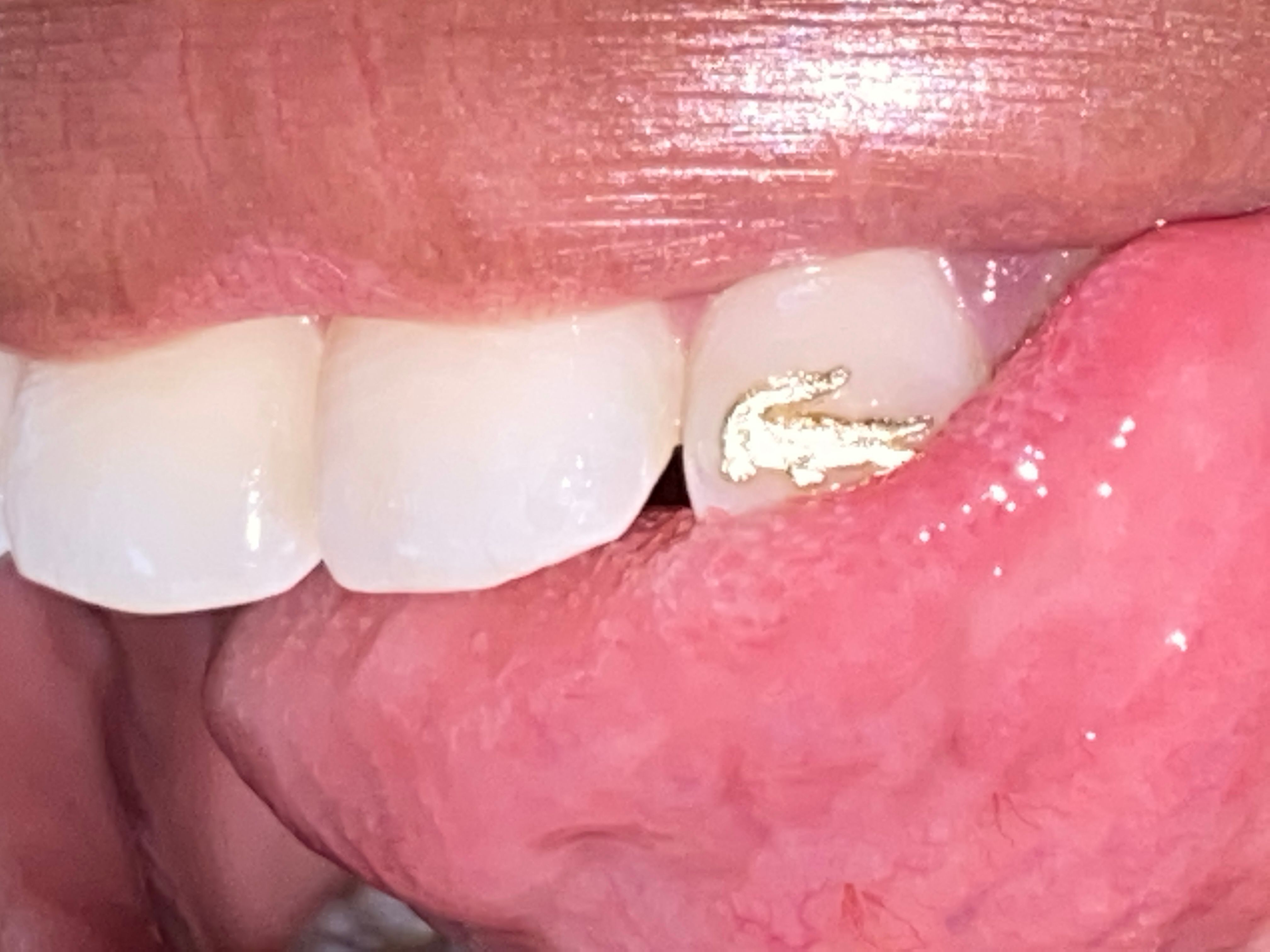 Last days of Lacoste, Galerie Créative in Paris!