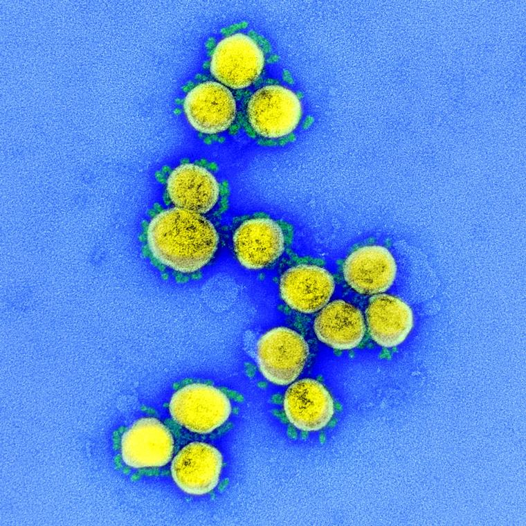 Bilde av koronavirus tatt i elektronmikroskop ved NIAID Integrated Research Facility (IRF) i Fort Detrick, Maryland