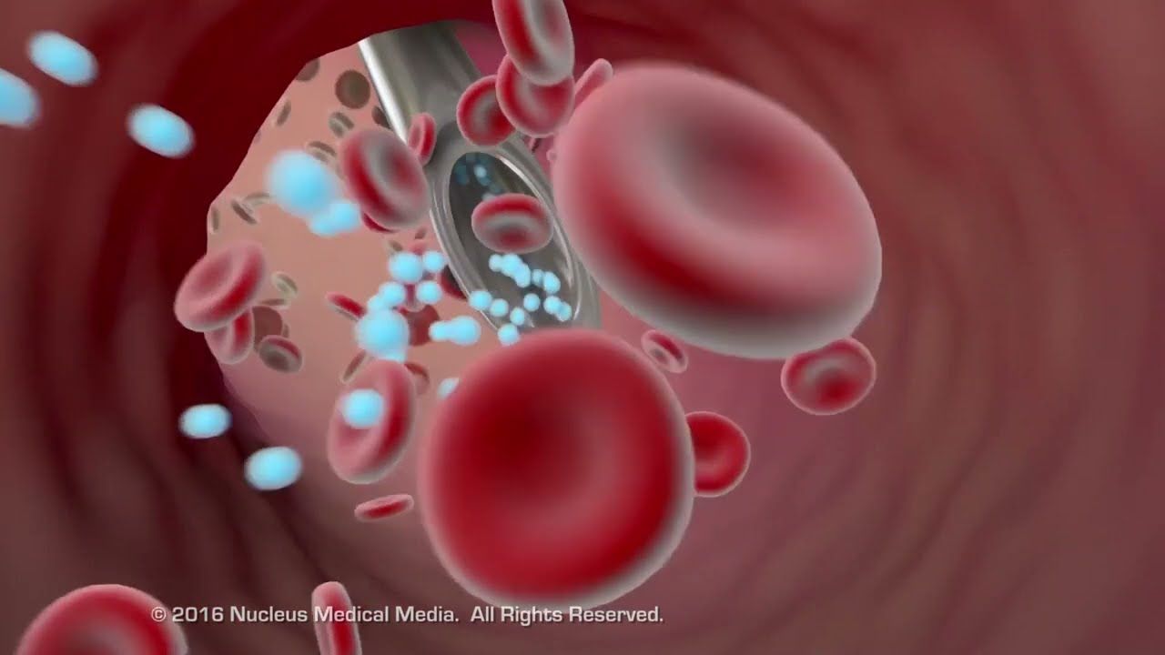 Where Is Eliquis Absorbed? GI Tract & Blood Thinner