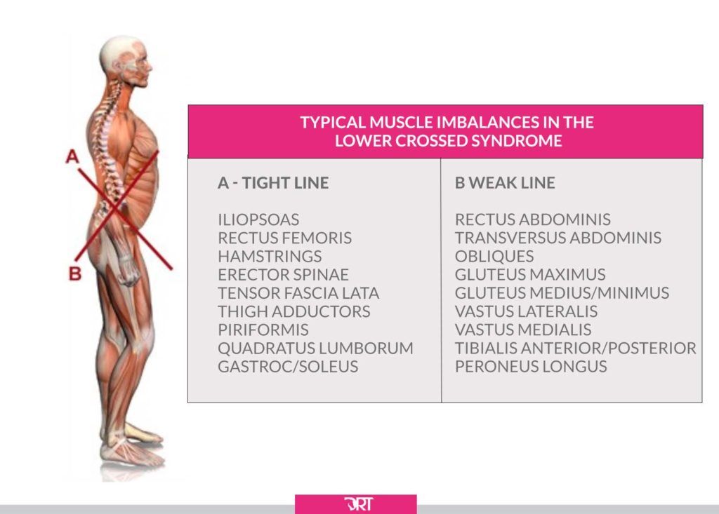 lower cross syndrome