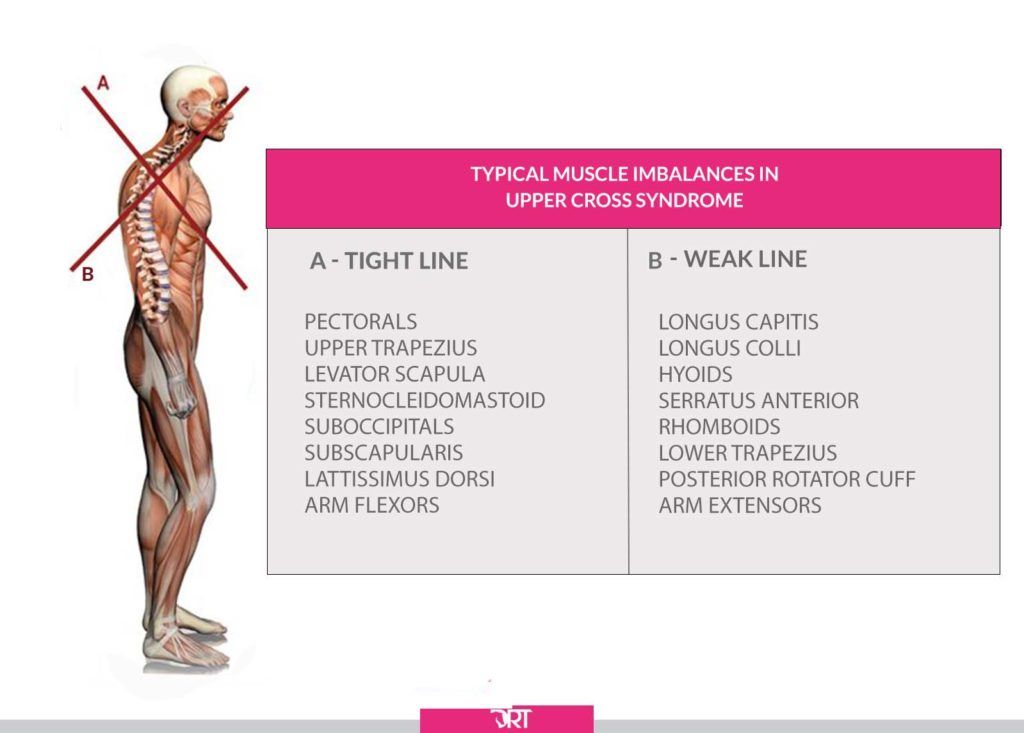Upper Cross Syndrome In Dressage Riders