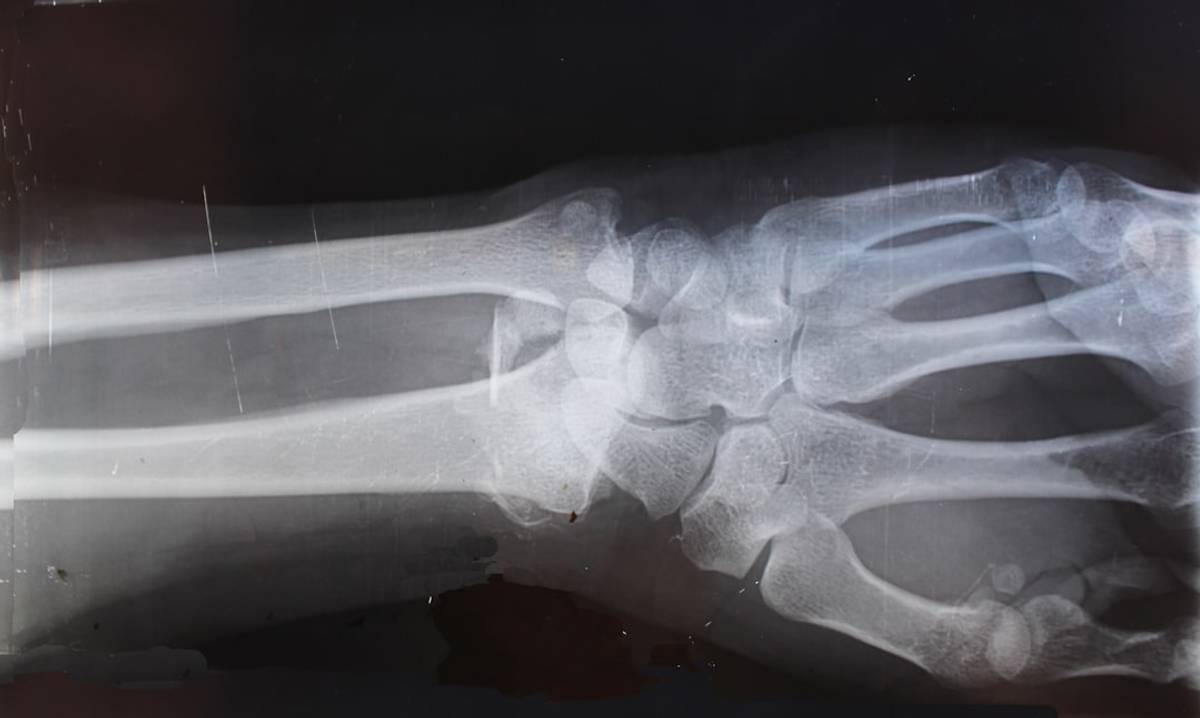 Google Ads for X-Ray Duplication Services: A Comprehensive Setup Guide