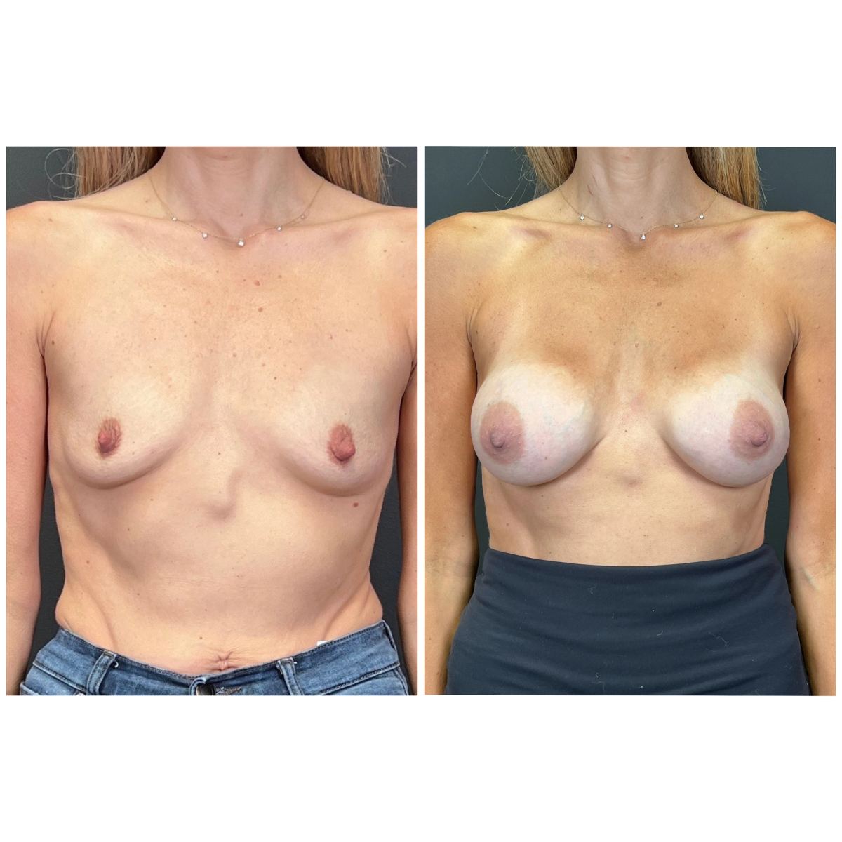 Motiva Preserve before and after