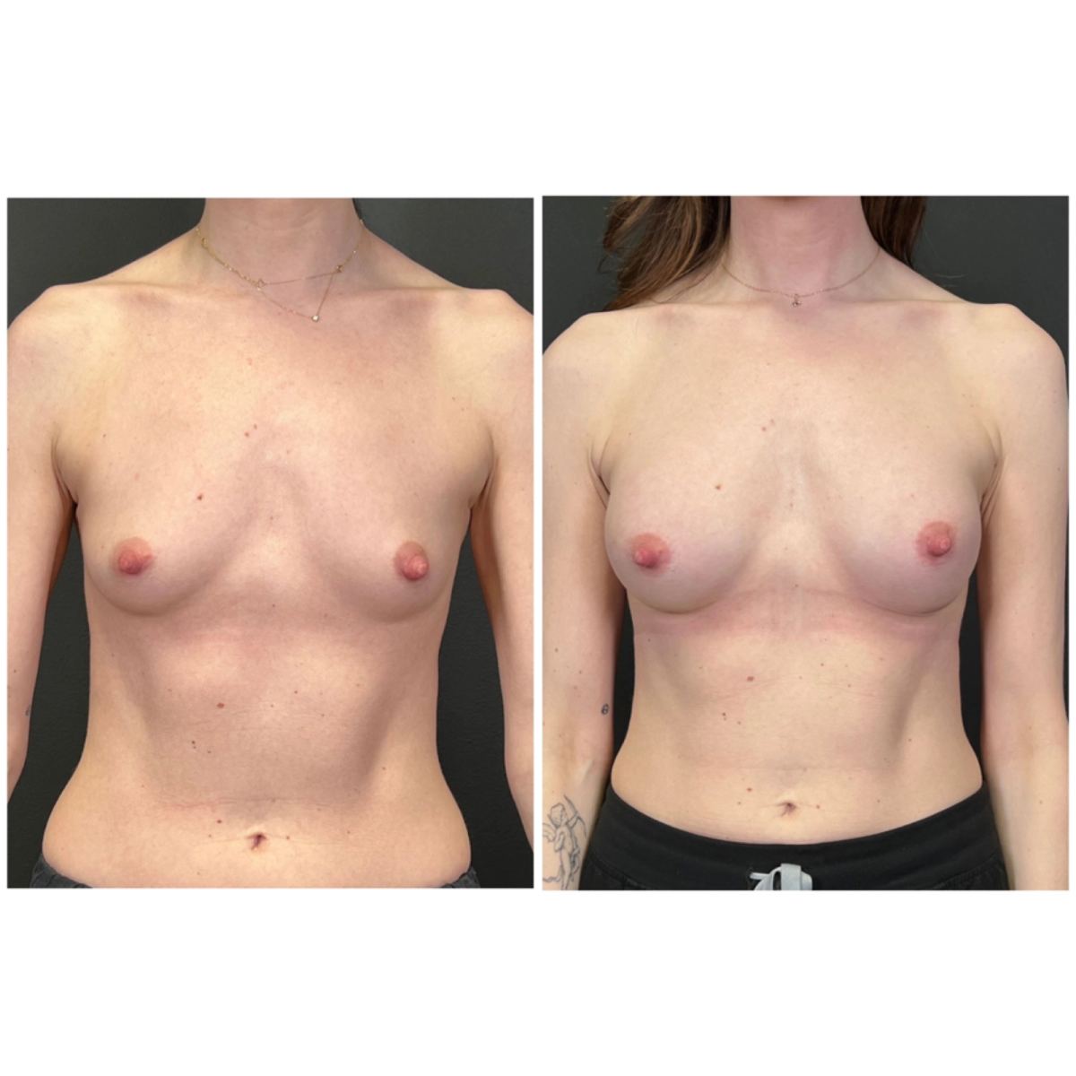 Motiva Preserve before and after