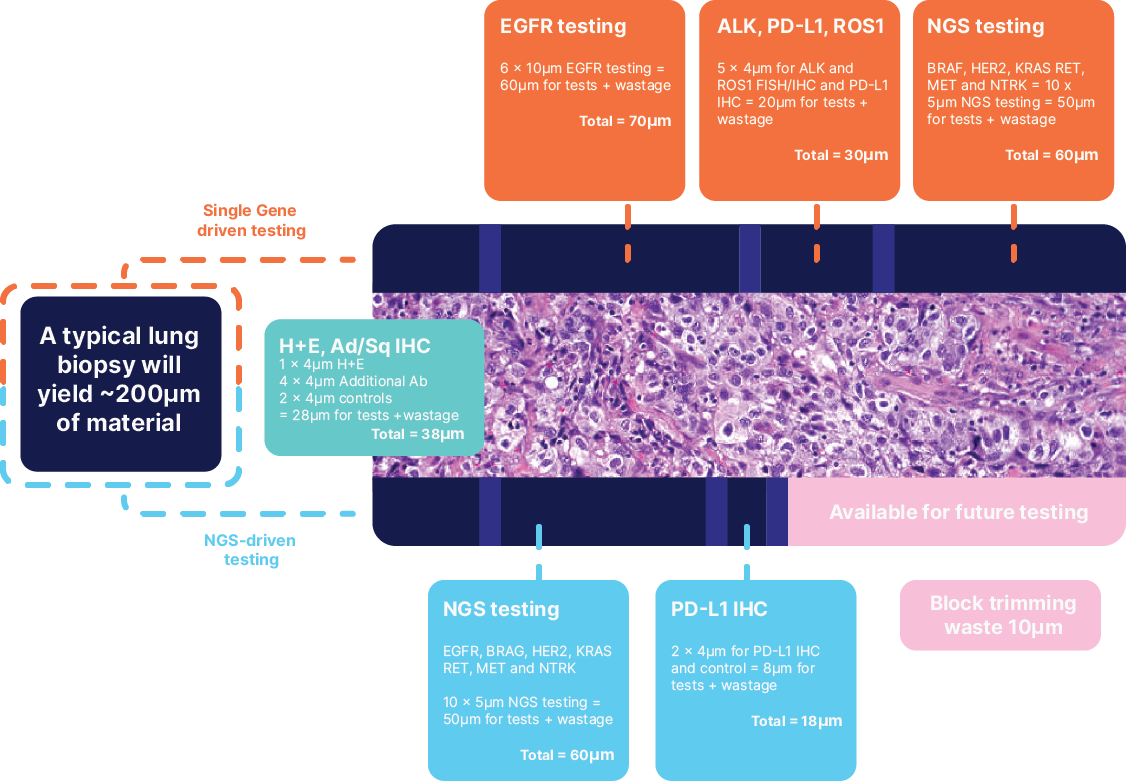 Representation of biomarker testing in NSCLC, showing tissue consumption via single gene testing vs NGS testing