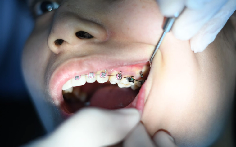 Dental checkup