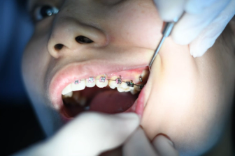 Dental checkup