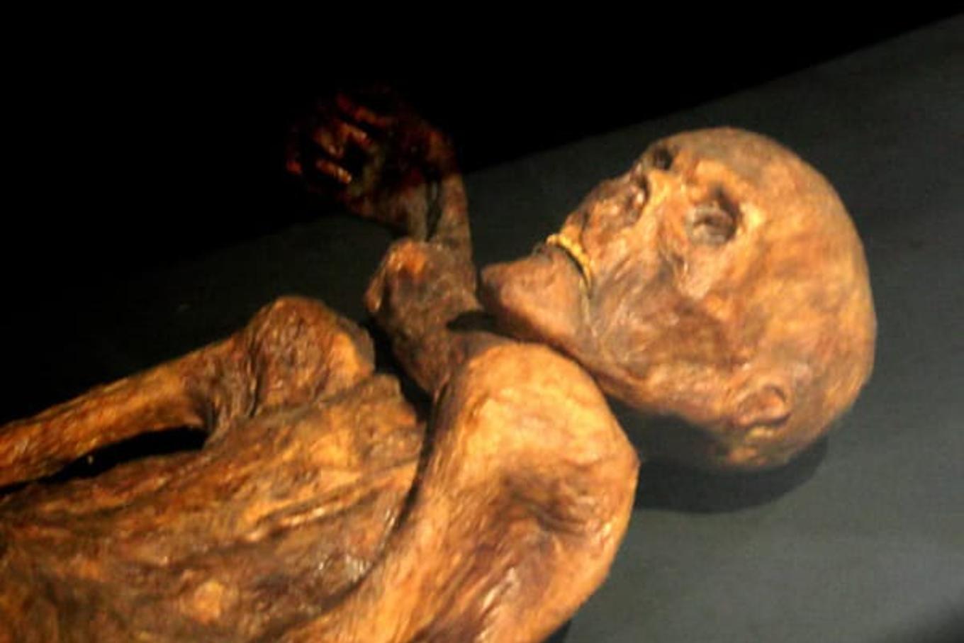 Ötzi the Iceman still hosts ancient gut bacteria and cold-loving yeasts