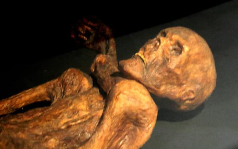 Ötzi the Iceman still hosts ancient gut bacteria and cold-loving yeasts
