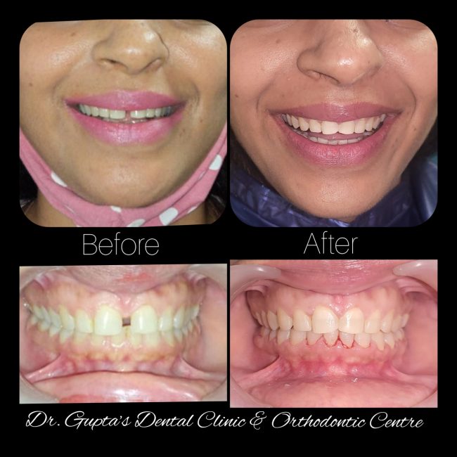 Gupta Dental clinic case photograph 4