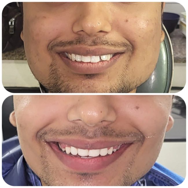 Gupta Dental clinic case photograph 10