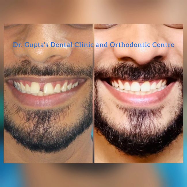 Gupta Dental clinic case photograph 9