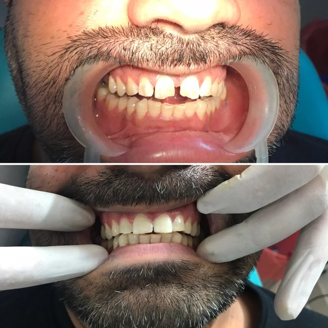 Gupta Dental clinic case photograph 11