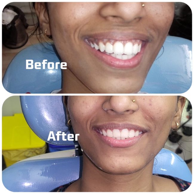 Gupta Dental clinic case photograph 8