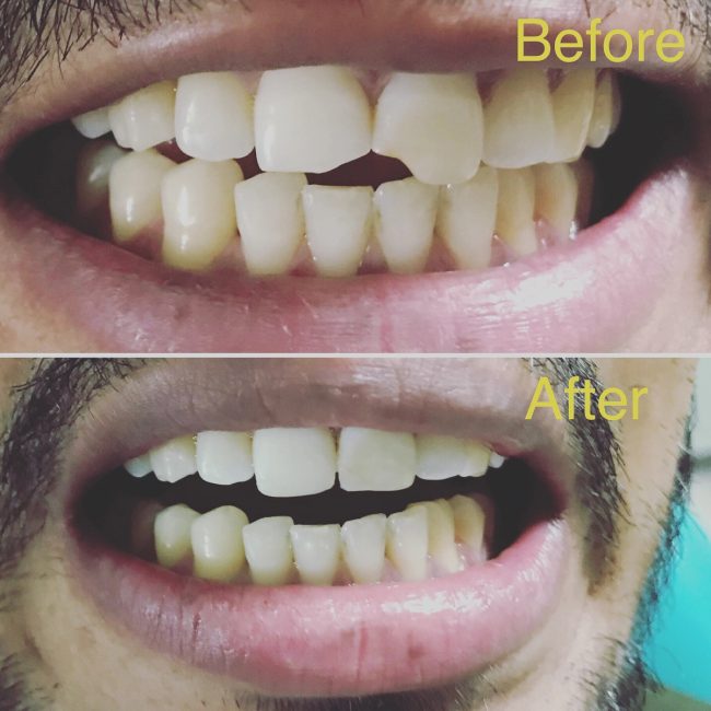 Gupta Dental clinic case photograph 12