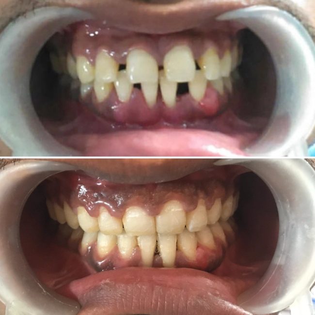 Gupta Dental clinic case photograph 7