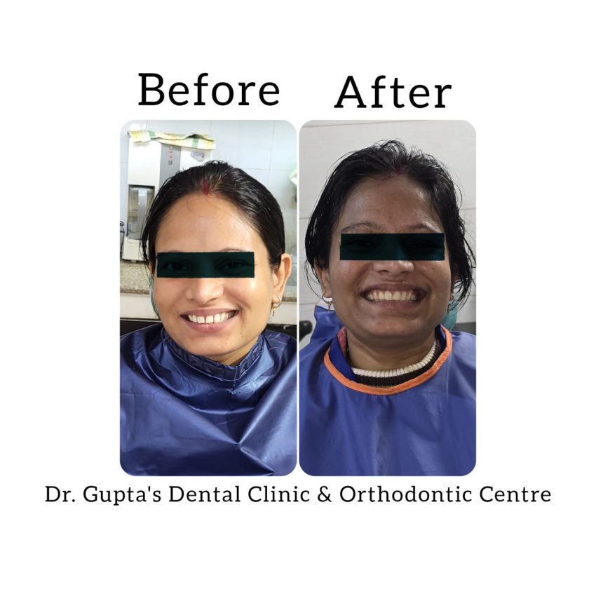Two portraits documenting a patient’s smile
