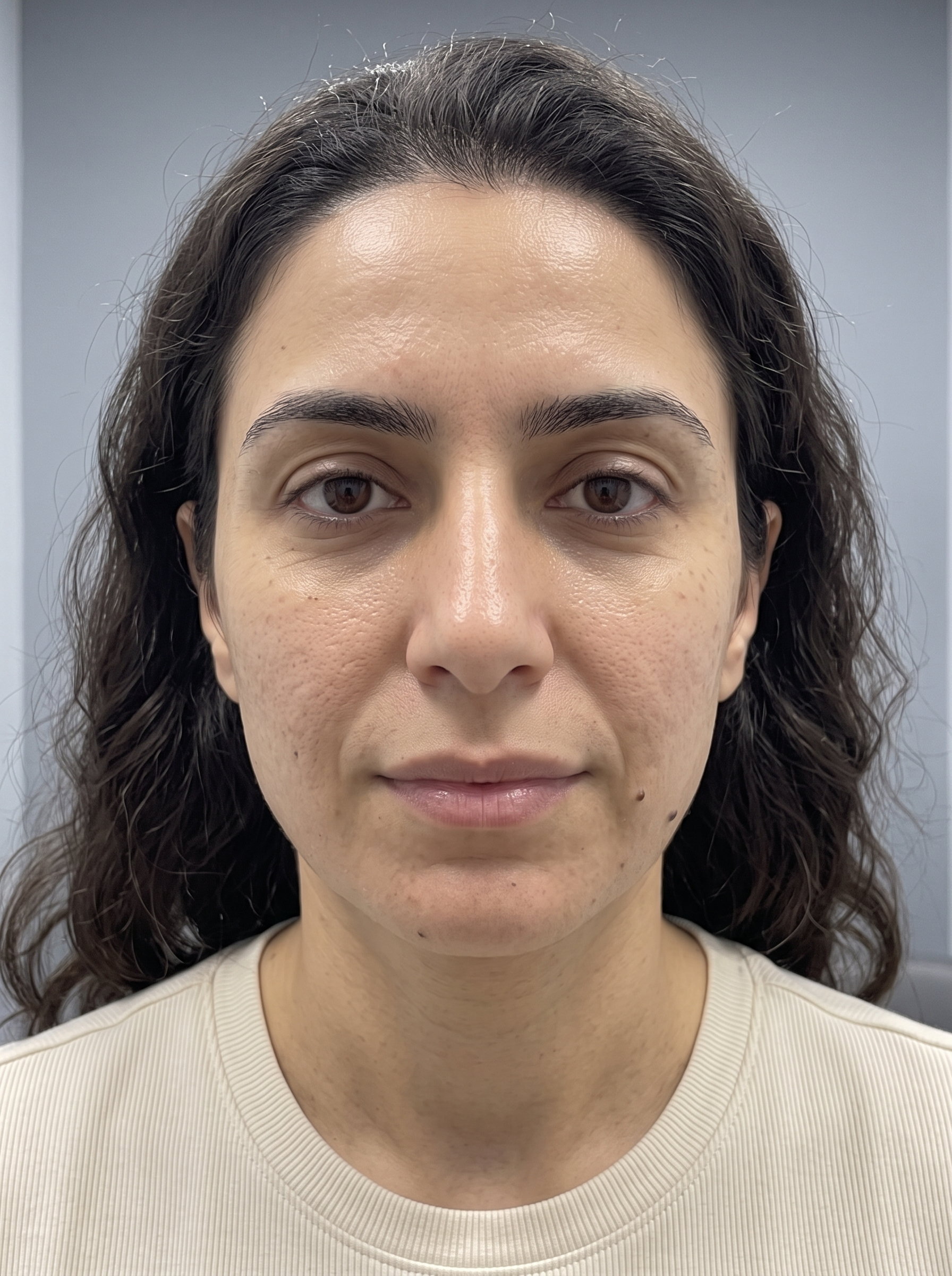 The same patient photographed at a later visit, from the same angle and under the same lighting.