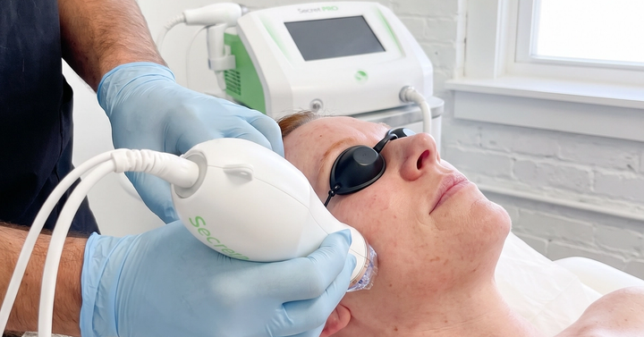Get Secret PRO by Cutera at Ideal Body Clinic in Montreal