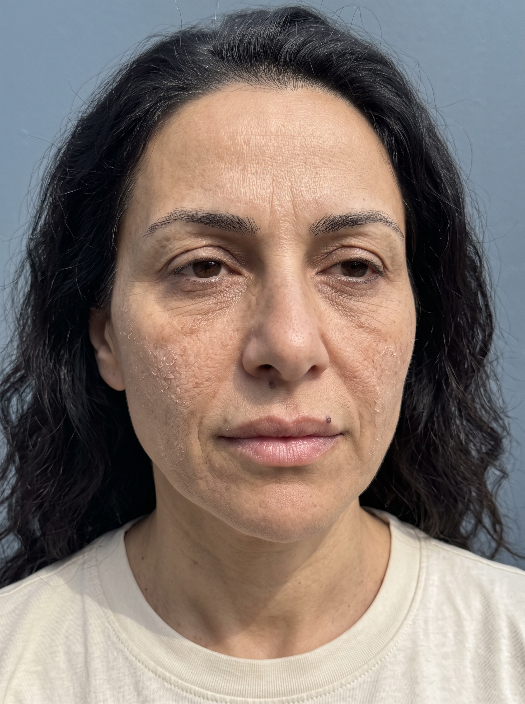Patient photographed before treatment, facing the camera under even, directional daylight.