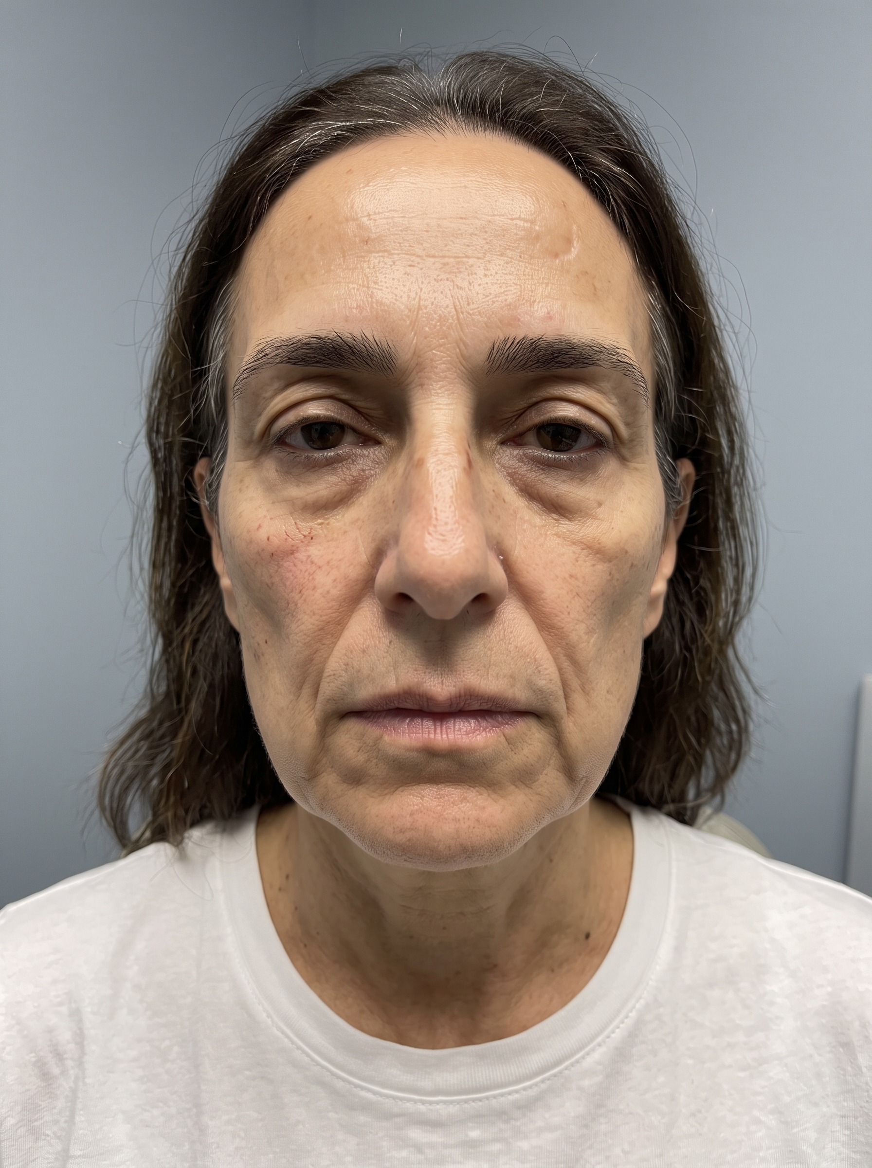 Patient photographed before treatment, facing the camera under even, directional daylight.