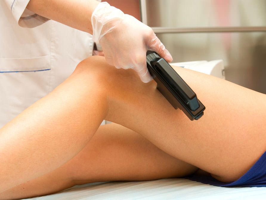 LT hair removal