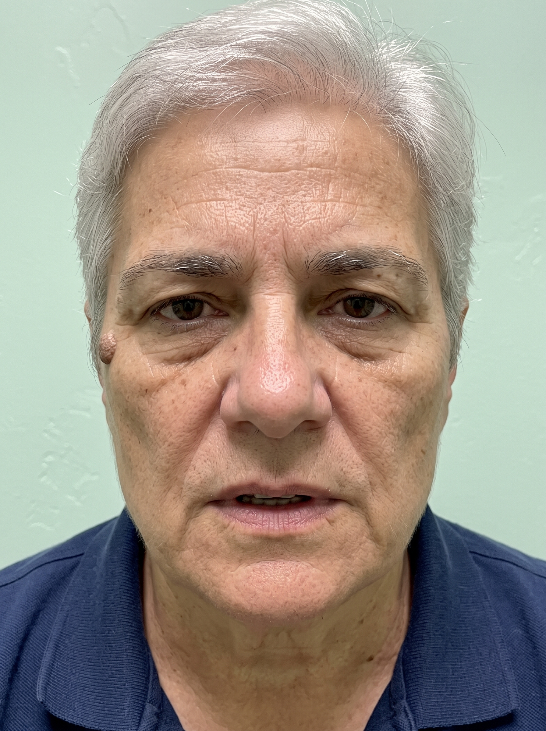 Patient photographed before treatment, facing the camera under even, directional daylight.
