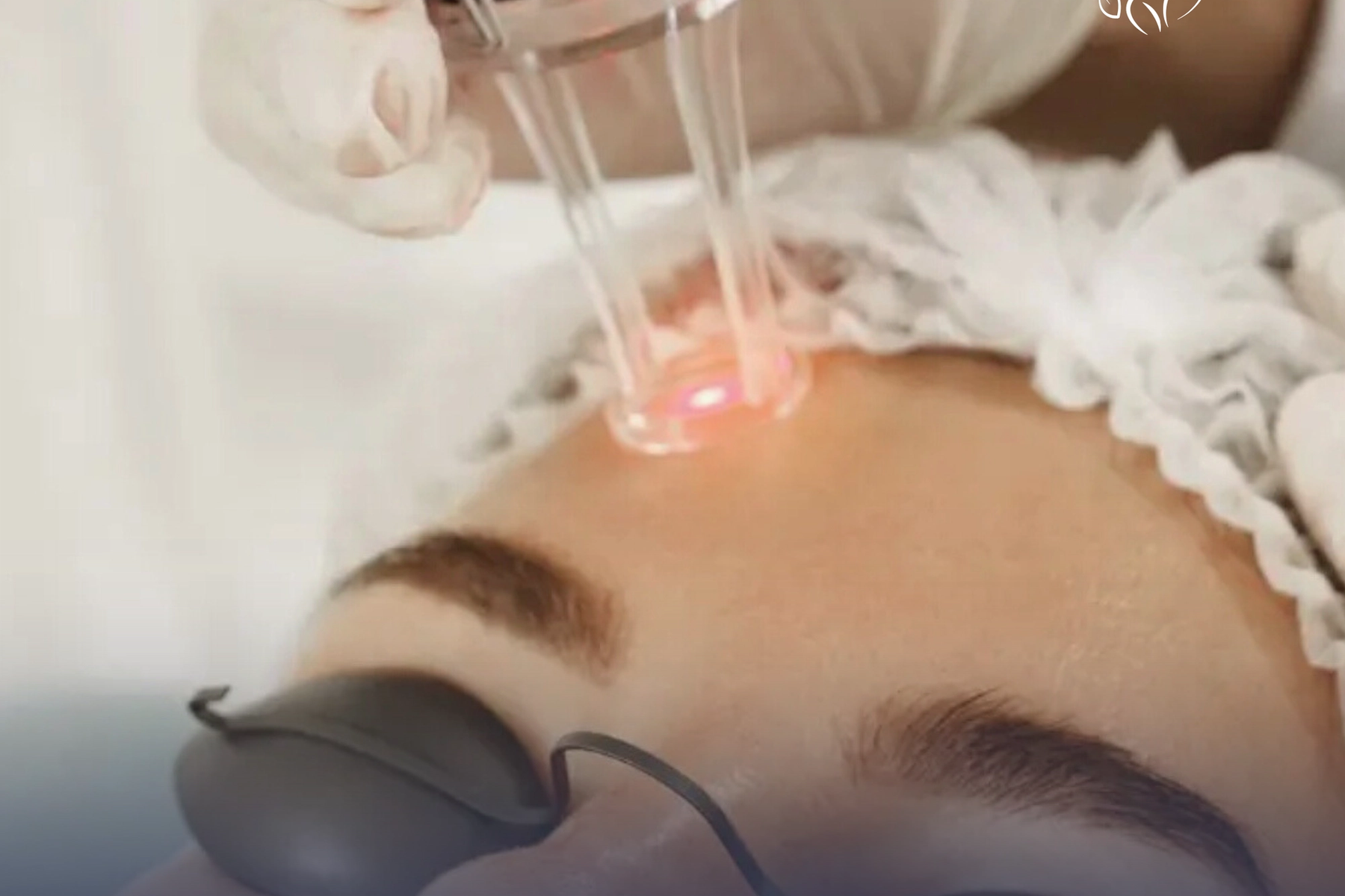 Découvrez les bienfaits de la thérapie par ondes de choc à Ideal Body Clinic