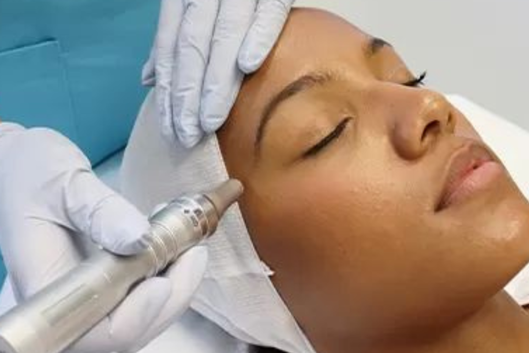 CryoPen vs. Plasma Pen: Which Treatment Is Right for Your Skin Concern?