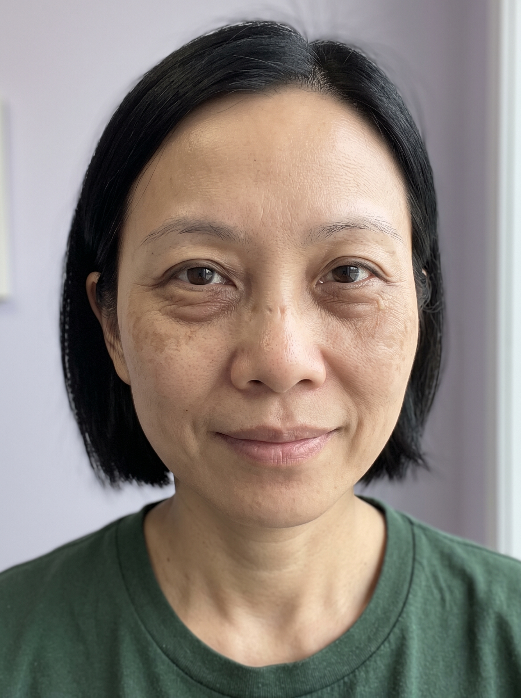 Patient photographed before treatment, facing the camera under even, directional daylight.