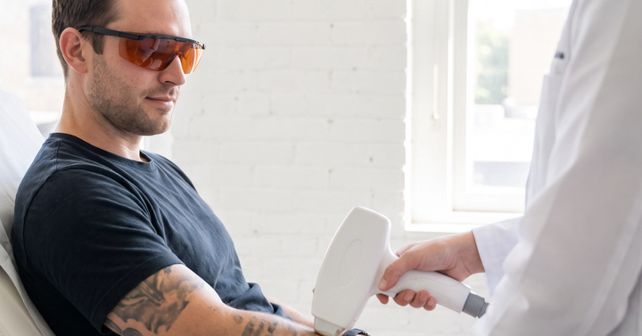 Tattoo Removal Montreal at our Ideal Body Clinic with CUTERA Enlighten