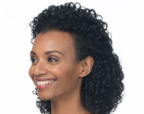 After Aesthetic Wrinkle relaxer Treatments for crows feet in Montreal