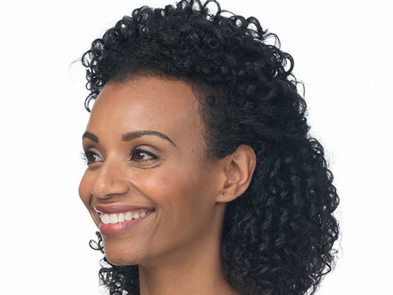 After Aesthetic Wrinkle relaxer Treatments for crows feet in Montreal