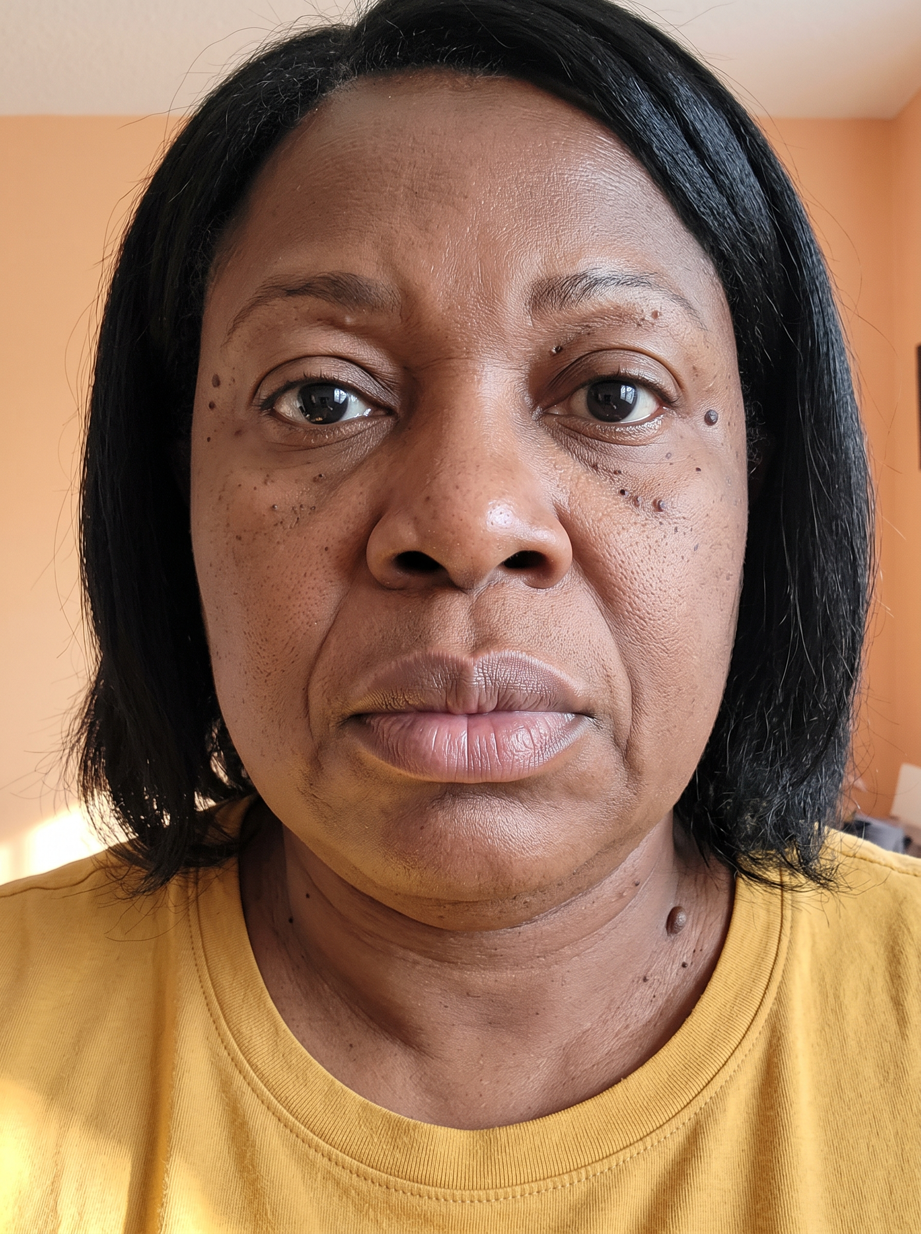Patient photographed before treatment, facing the camera under even, directional daylight.