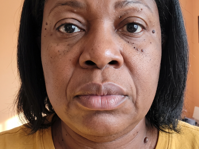 Patient photographed before treatment, facing the camera under even, directional daylight.