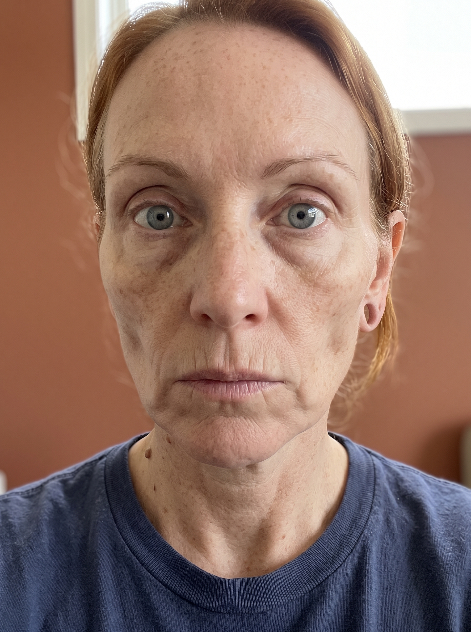 Patient photographed before treatment, facing the camera under even, directional daylight.