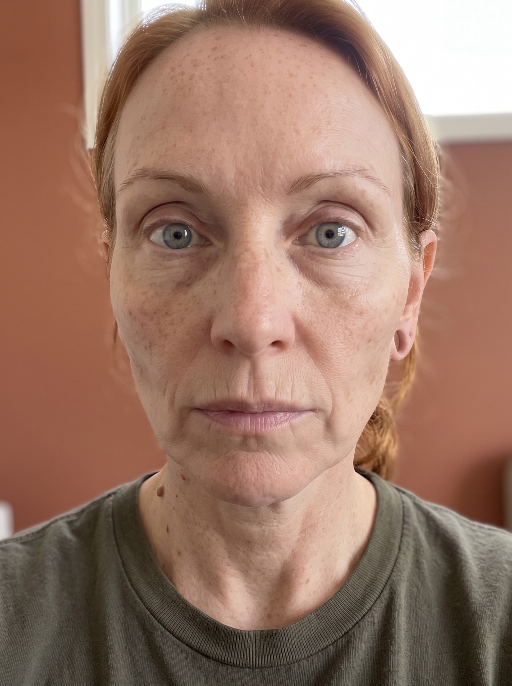 The same patient photographed at a later visit, from the same angle and under the same lighting.