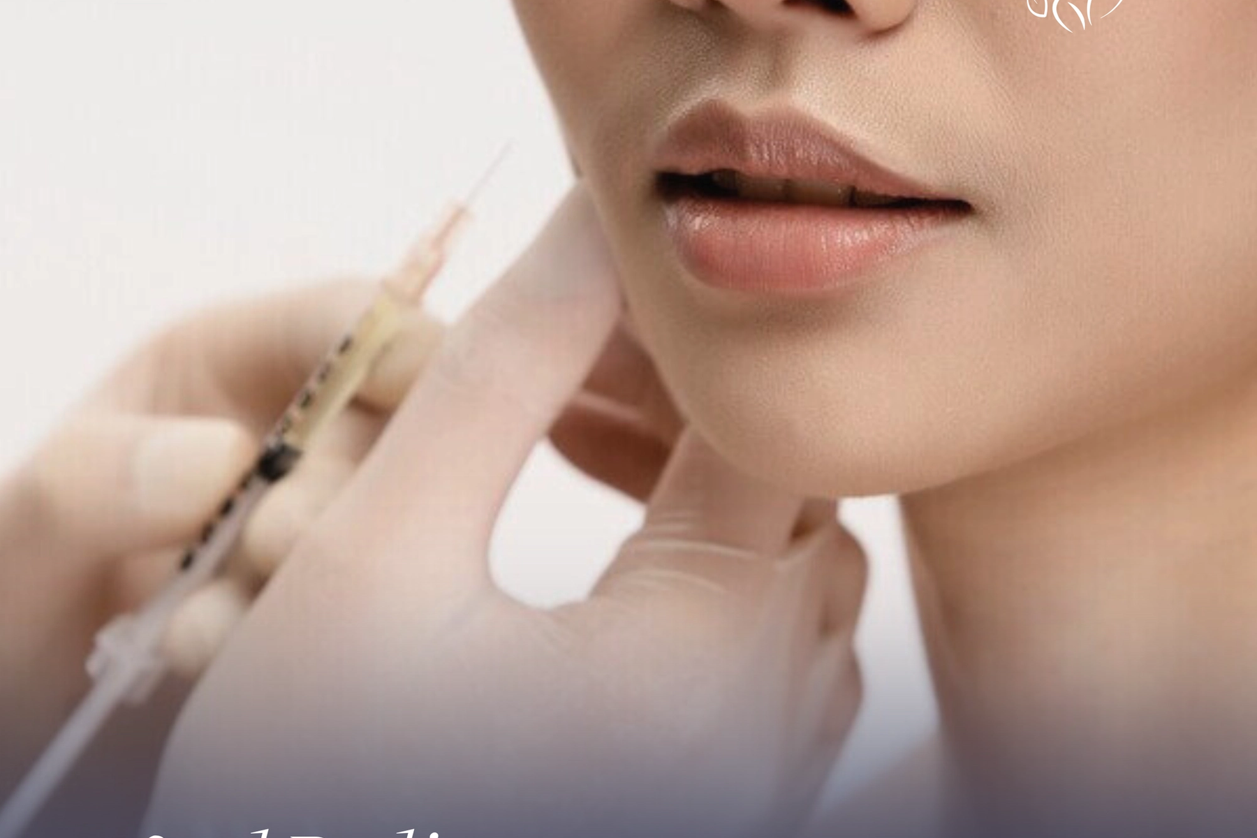 Sublimez vos courbes naturellement : Le Liquid BBL avec Collagen-stimulating filler (PLLA) et Collagen-stimulating filler (CaHA) à la Clinique Corps Ideal