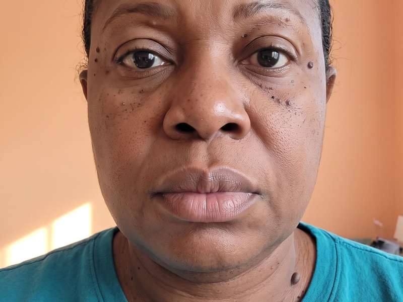 The same patient photographed at a later visit, from the same angle and under the same lighting.