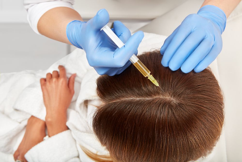 Hair Restoration with PRP Therapy: A Natural Solution for Hair Loss
