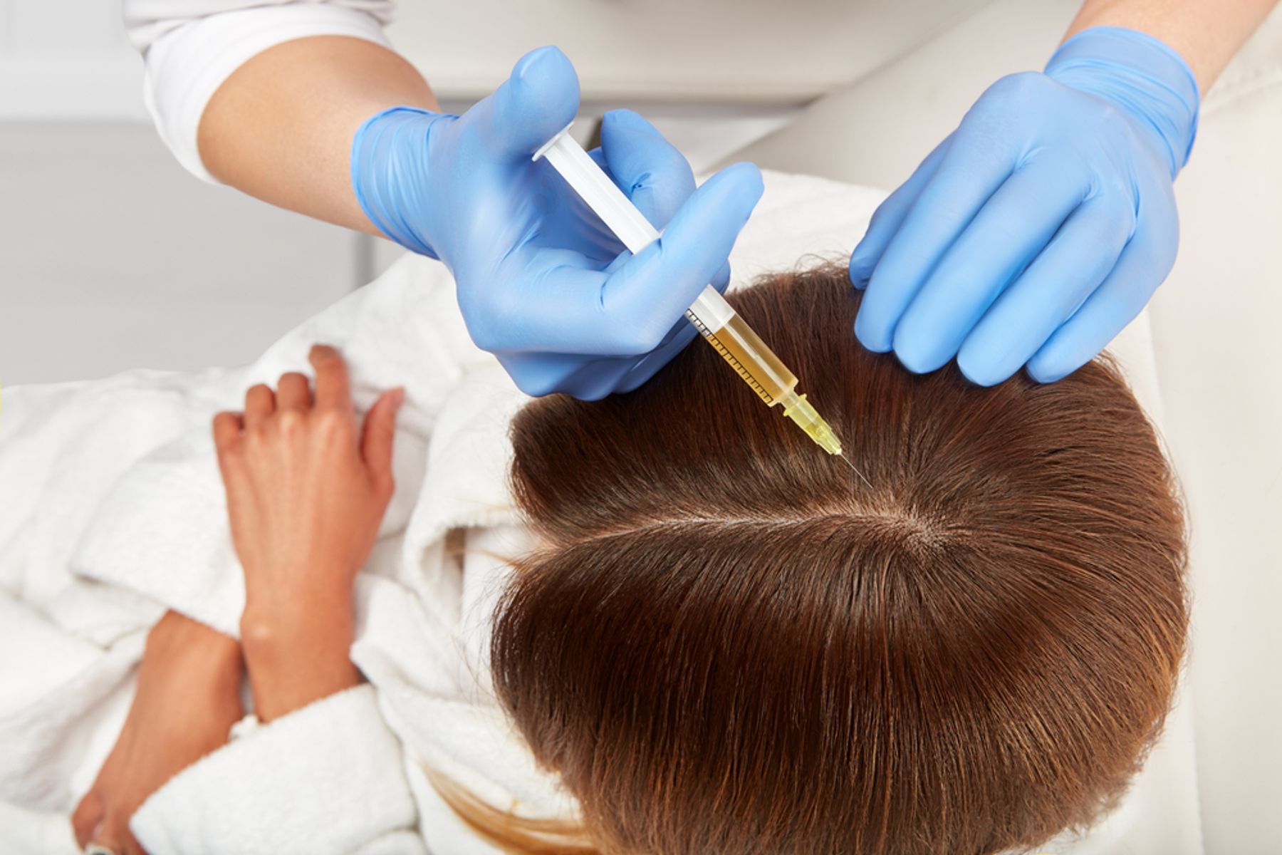 🌿 Hair Restoration Program at Ideal Body Clinic