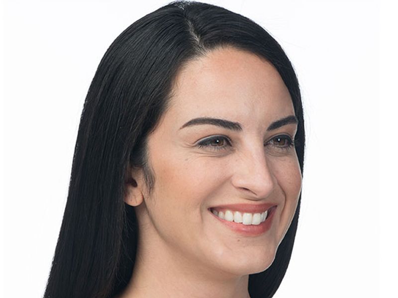 After Aesthetic Wrinkle relaxer Treatments for crows feet in Montreal