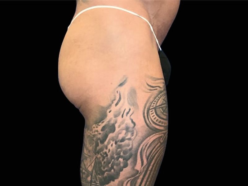 Male glutes Before Emsculpt NEO Body Contouring fat removal therapy in Montreal