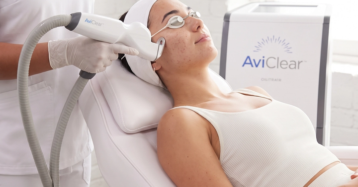 AviCLear laser acne removal in Montreal