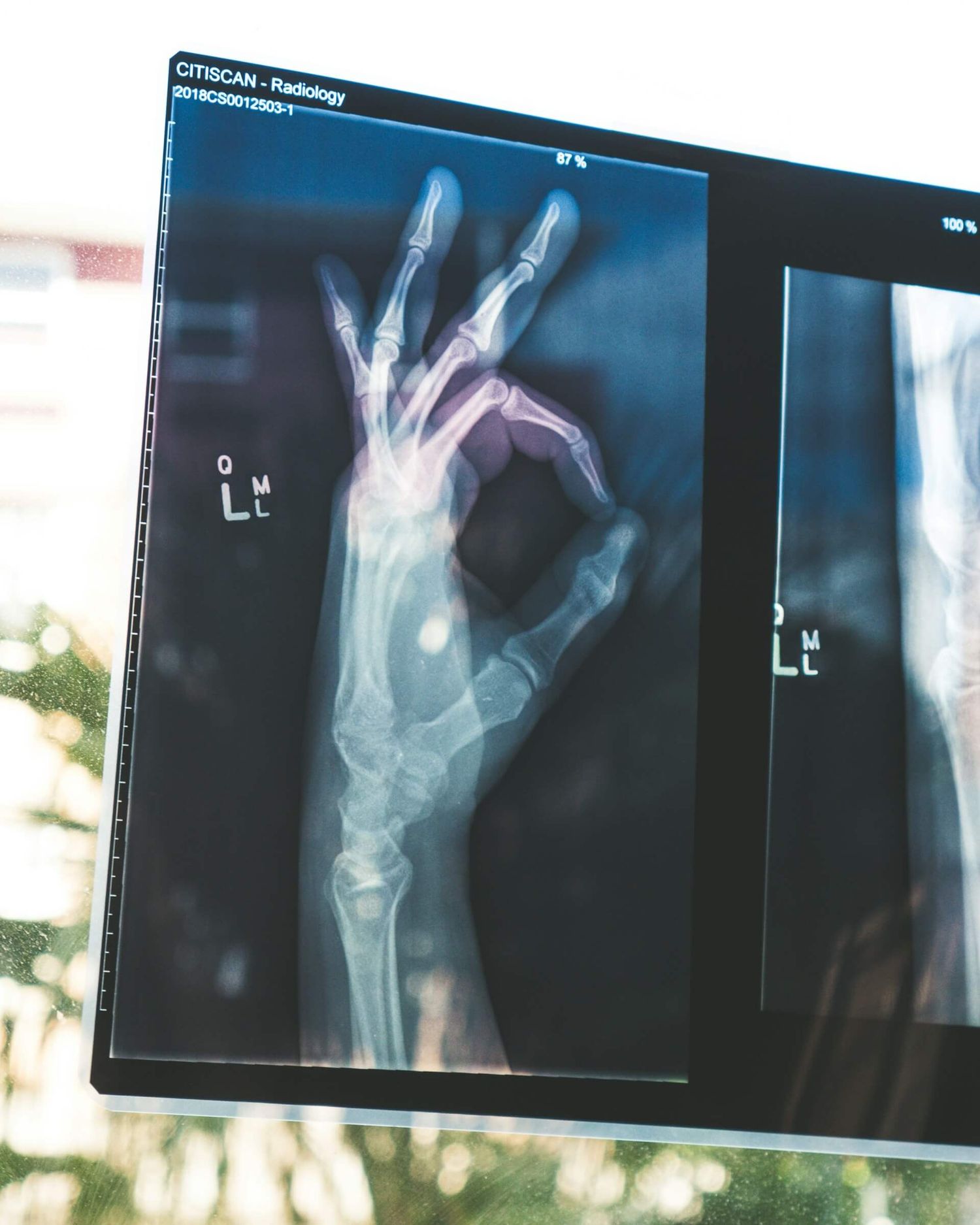 Medtech startups niches screen with hand